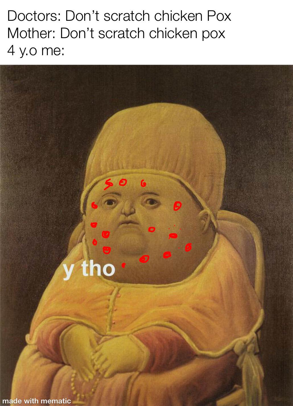 Doctors: Don't scratch chicken pox 4yo me: meme