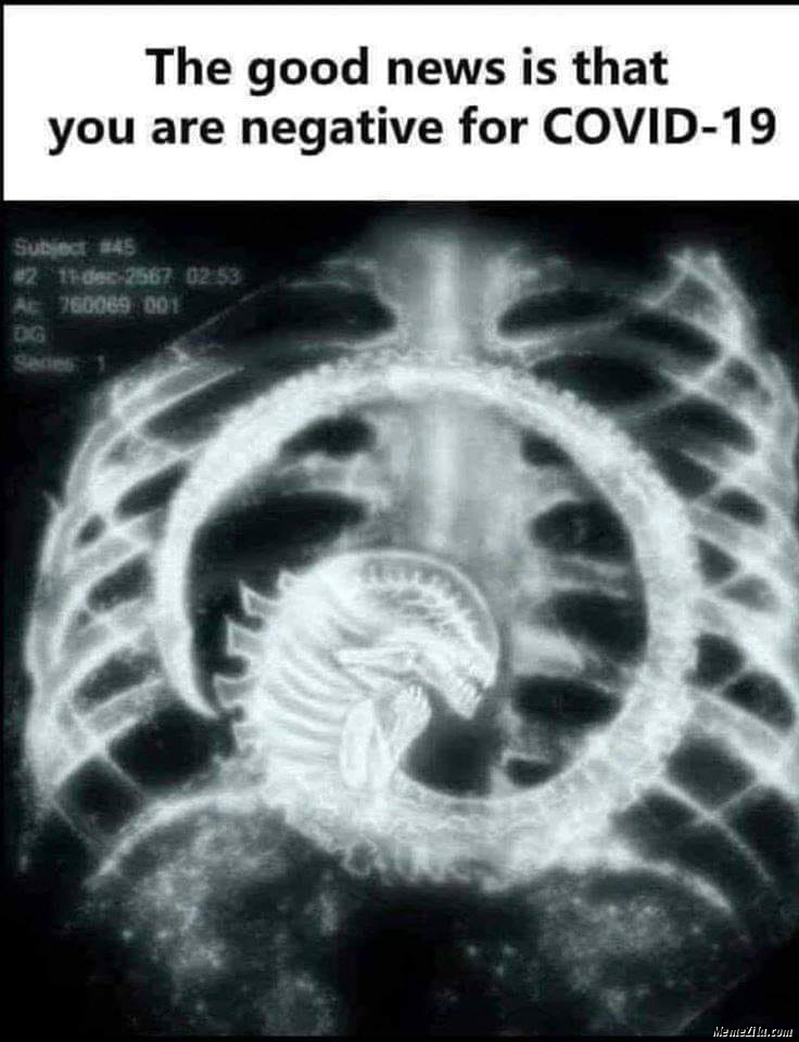 The good news is that you are negative for covid-19 meme